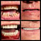 Slider image (9) Kool Dental